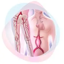 Ilustración de un examen Eco Doppler