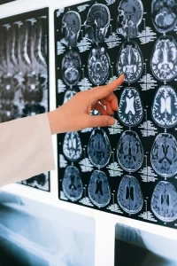 Médico estudiando imágenes de gammagrama cerebral en un panel de luz