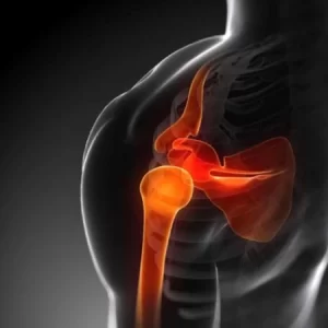 Imagen de ArtroResonancia de la articulación del hombro