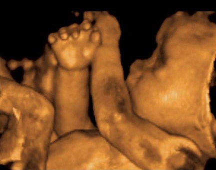 Ecografía 4D de un bebé en el vientre materno