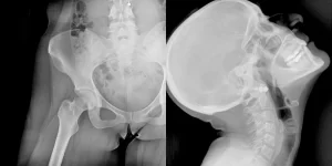 Radiografías dinámicas de pelvis y cráneo