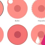 Señales comunes del cáncer de mama, incluyendo endurecimiento, bultos y hoyuelos en el pecho.